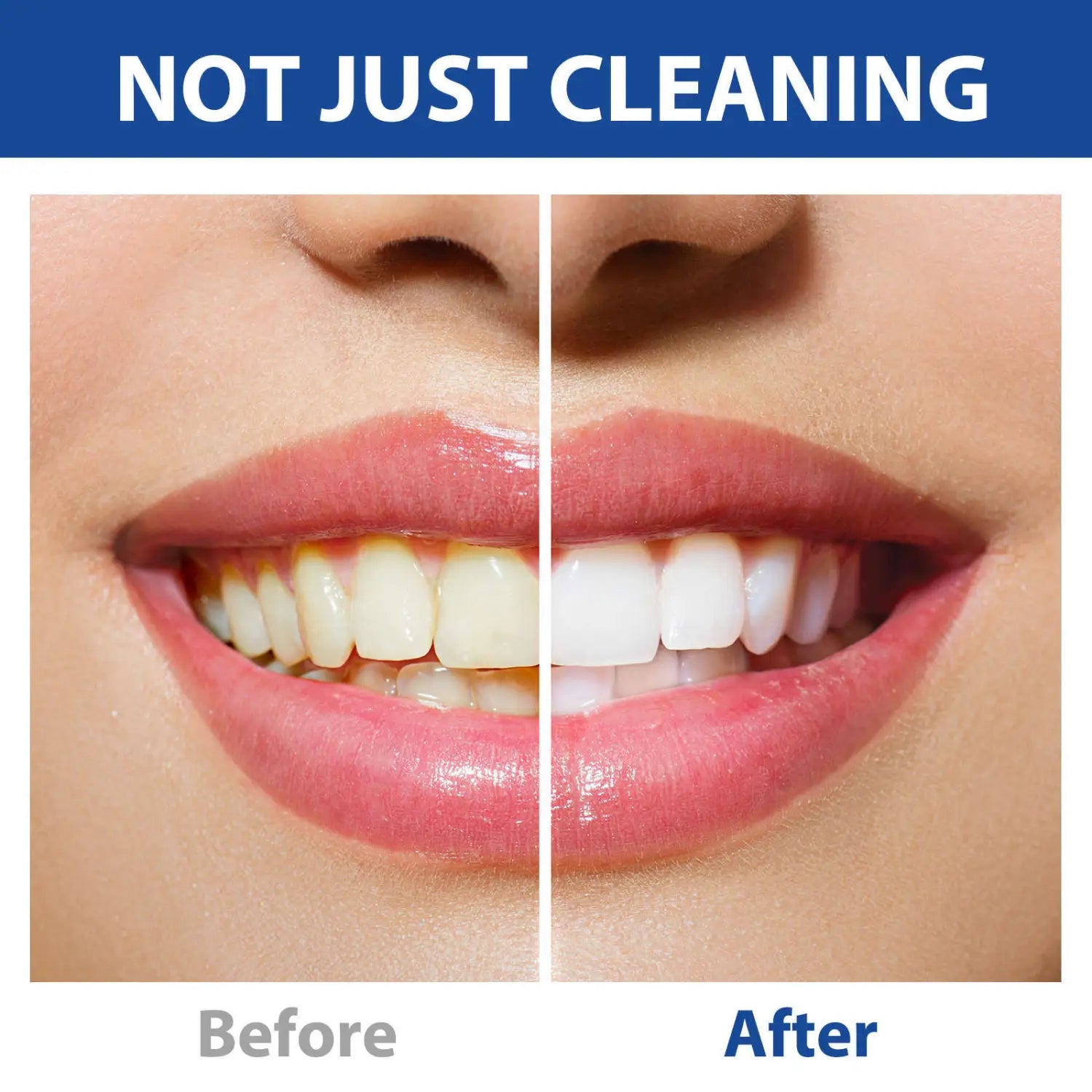 A pair of bright evenly whitened teeth with glossy pink lips showcasing the results of using solid toothpaste tablets portable breath mint 62pcs.