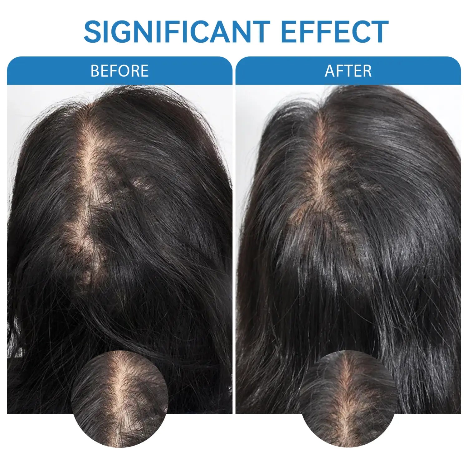 Before-and-after comparison of dark black human hair showing visible scalp thinning and significantly fuller hair density after using Blue Copper Peptide Hair Growth Serum 30ml.