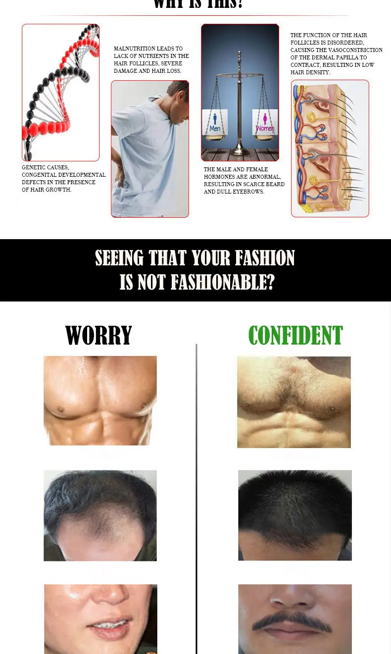 The infographic explains hair loss causes and contrasts worry and confident body types while promoting beard growth oil for natural repair and nourishing care.