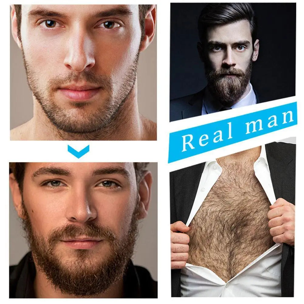 The image displays a collage of four distinct male portraits showcasing various facial hair styles and body hair presence for a beard growth kit with derma roller and serum set.