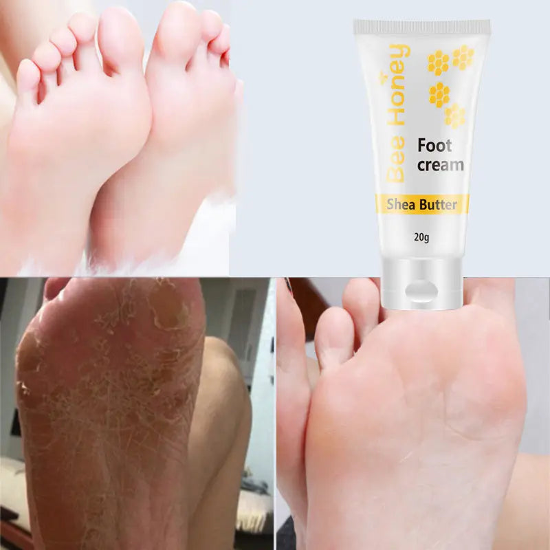 White tube of honey foot cream with yellow floral design labeled shea butter 20g in a moisturizing gel sock set