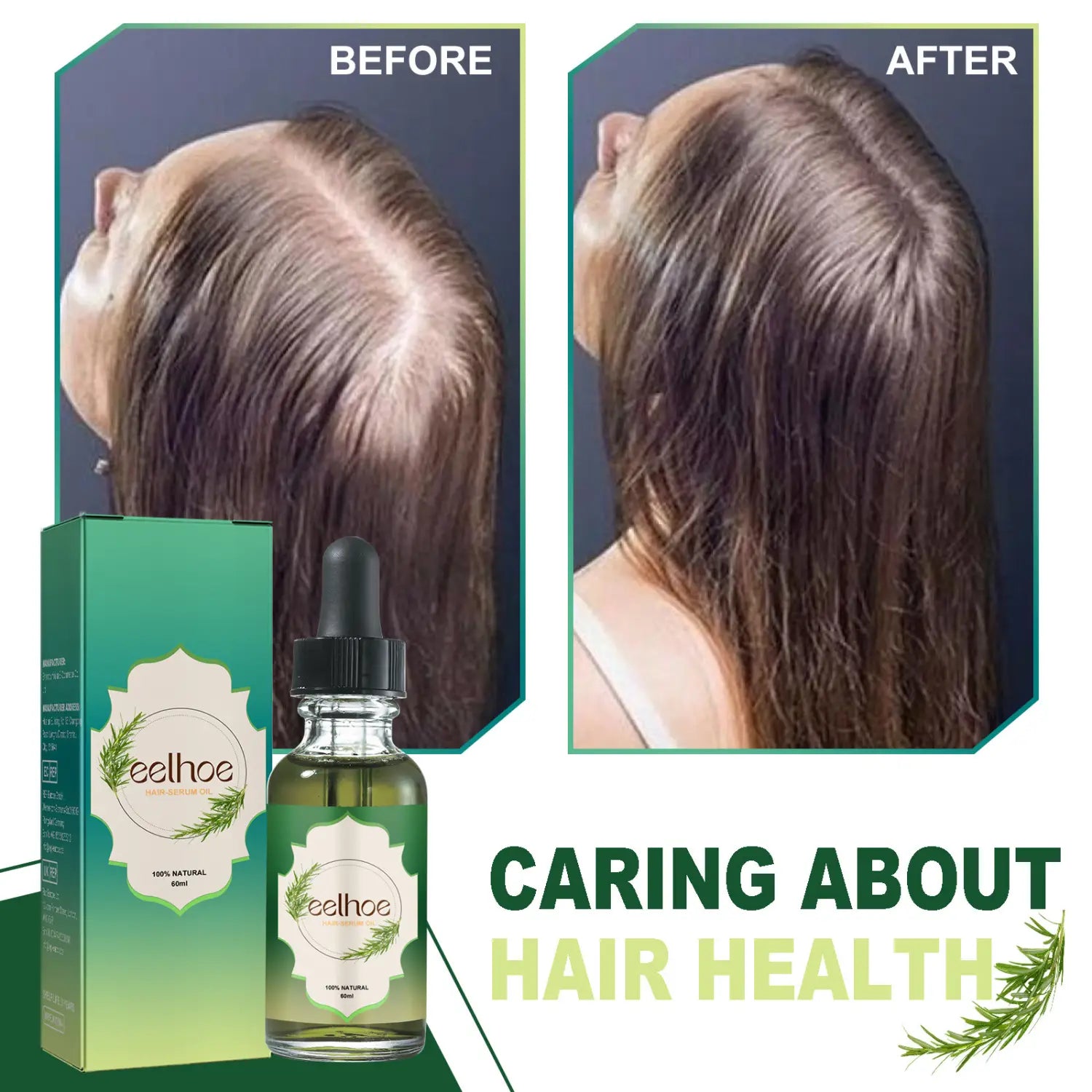 Green glass bottle with black dropper cap and matching green box labeled eelhoe featuring a leaf design containing 60ml rosemary hair essential oil for growth.