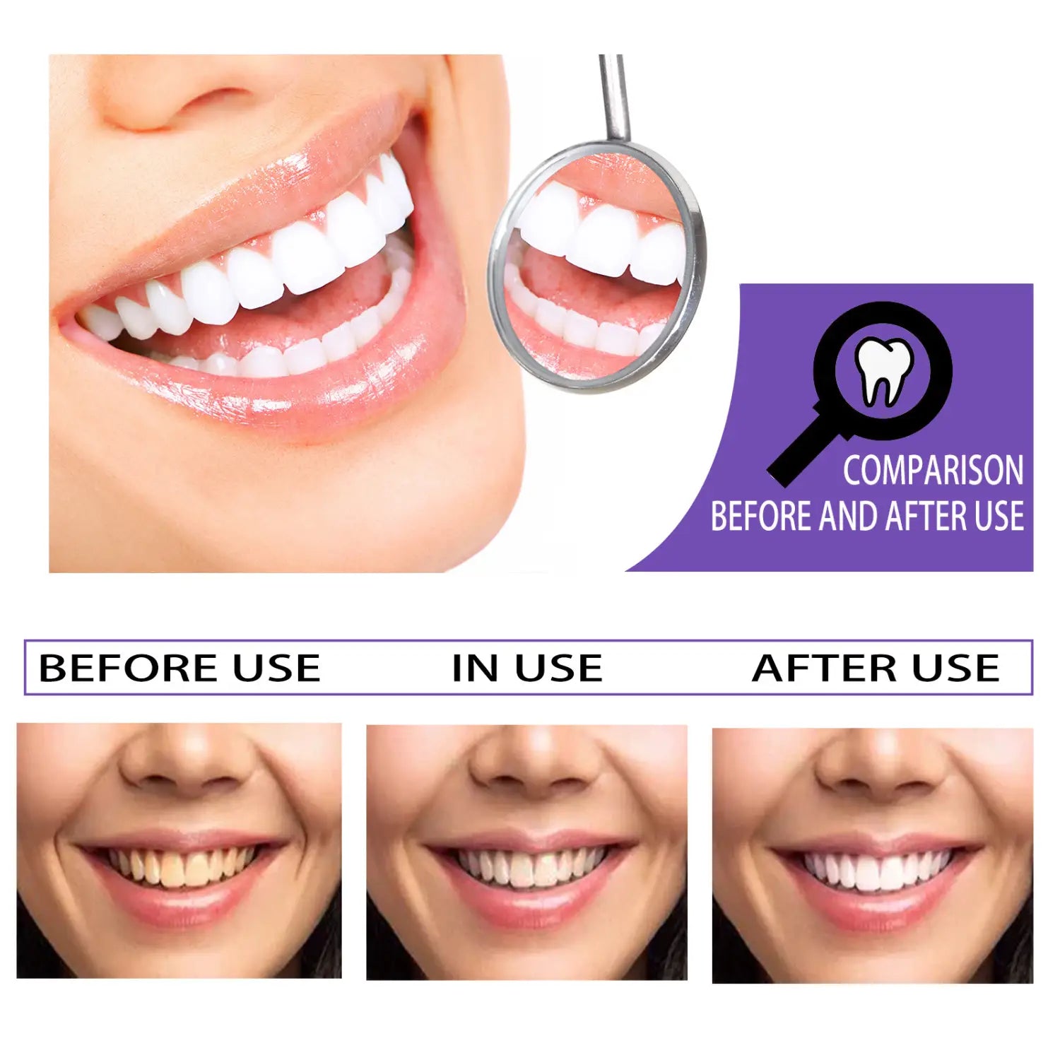 a close-up smile showing a set of white glossy teeth with a magnifying glass highlighting detailed comparison for teeth whitening toothpaste purple color corrector 30ml