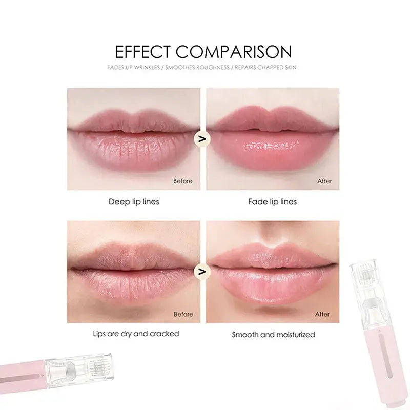 Rodillo de hidratación con microagujas para el suero de labios y barba, con cuerpo rosa y transparente y cartucho transparente.