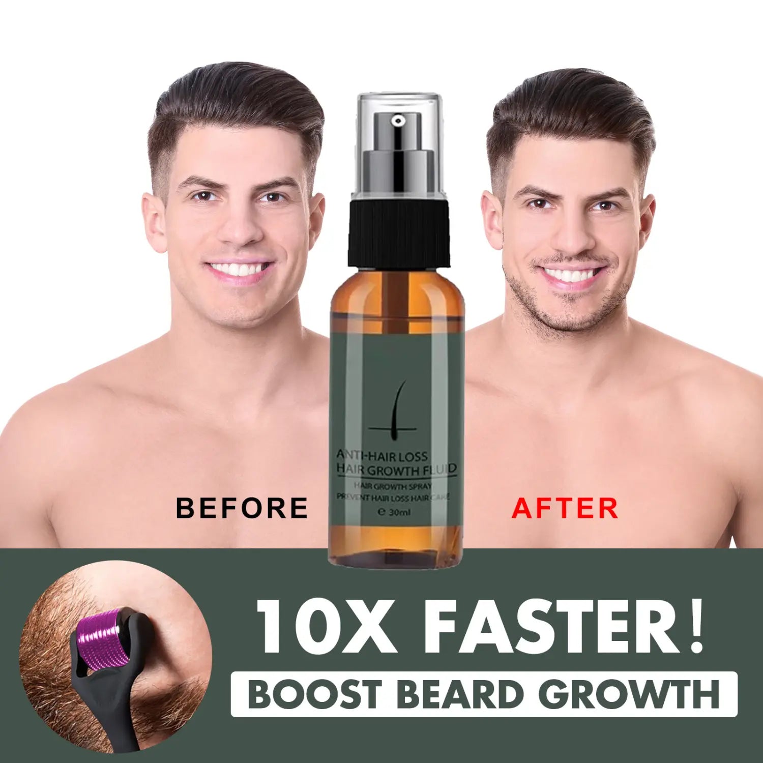 「ひげ育毛スプレーおよびダーマローラーキット30ml」における、黒いスプレーノズルとシルバーのキャップが付いた琥珀色のガラス瓶で、「抜け毛予防の発毛促進育毛液」とラベル表示されたもの。