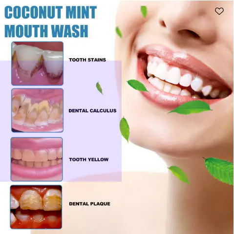 Enjuague bucal de coco y menta para blanqueamiento dental y cuidado bucal de 50 ml en un frasco transparente con una tapa blanca, diseñado para blanquear los dientes y eliminar las manchas.