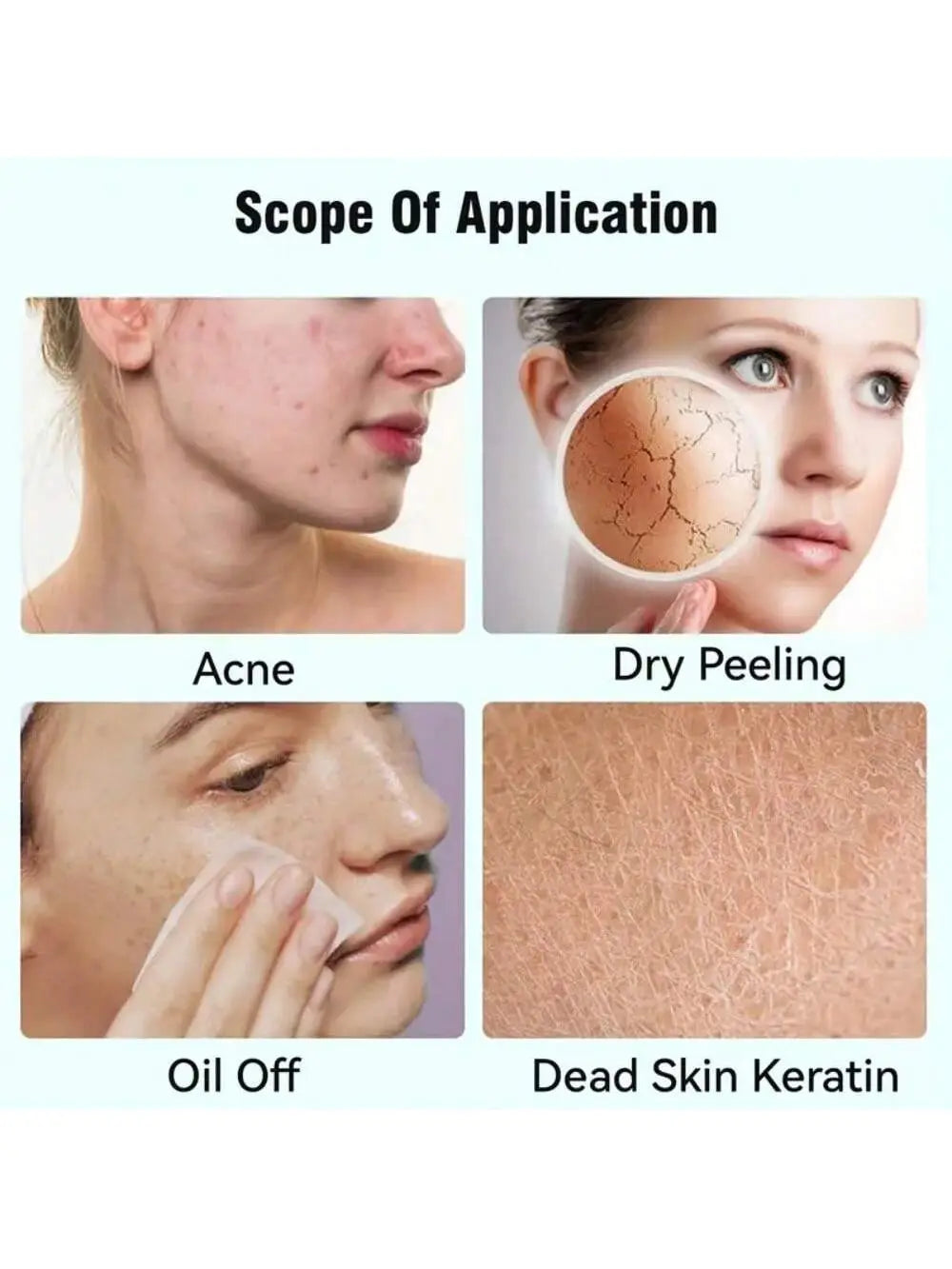 The image shows the back side of a white portable rechargeable nano mist facial hydration nebulizer designed for acne treatment, dry peeling, oil removal, and dead skin keratin care.