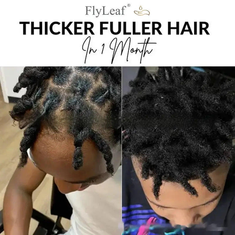 Aceite para el cabello de menta Flyleaf en un frasco verde oscuro diseñado para promover rastas negras más gruesas y abundantes, a la vez que favorece el cuidado del cuero cabelludo y el crecimiento.