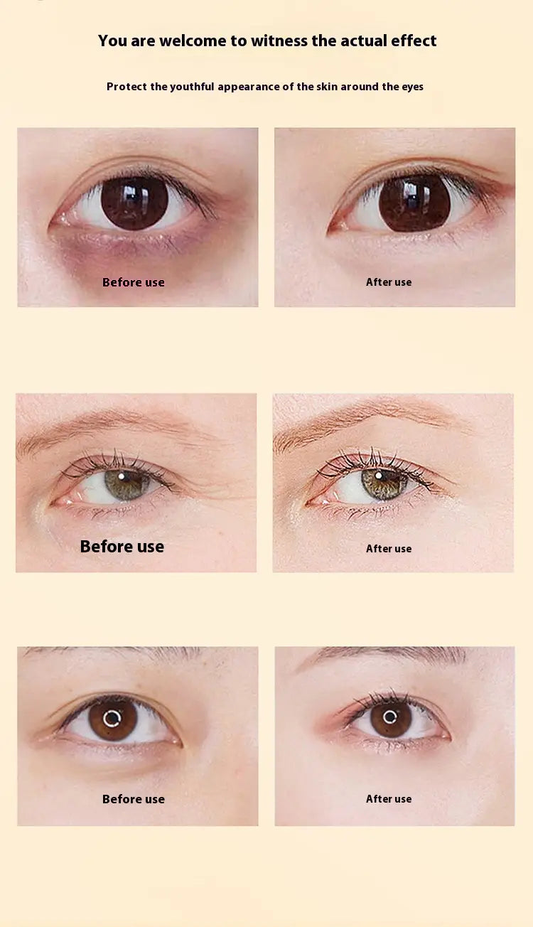 Lutein Eye Essential Oil Hydrating Vc Serum 8ml is an eye-area skincare product designed to reduce dark circles and fine lines shown in before and after comparisons on different eye types.
