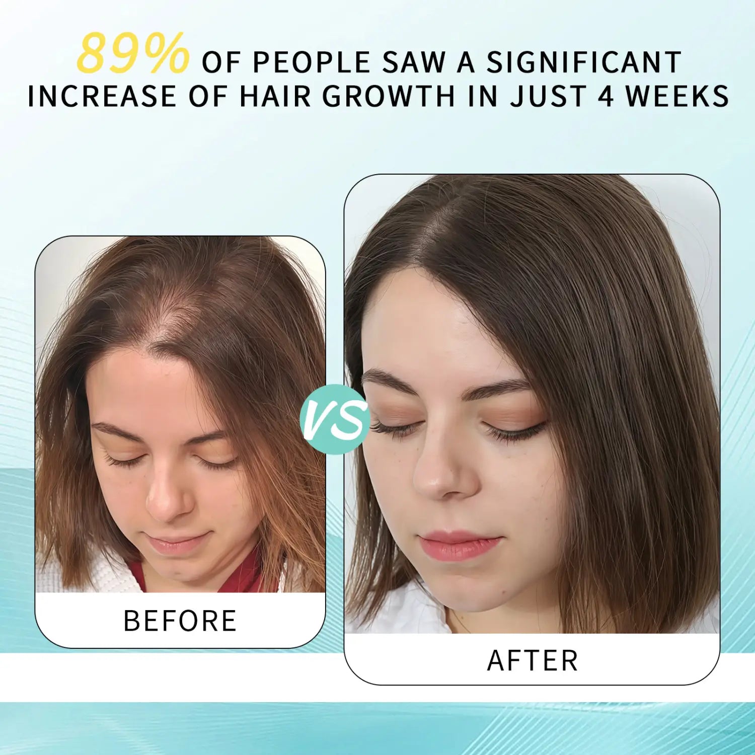 Una mujer con cabello largo castaño oscuro que muestra mayor volumen y densidad después de cuatro semanas de tratamiento con aceite de crecimiento de cabello con ricino y romero y masajeador del cuero cabelludo.