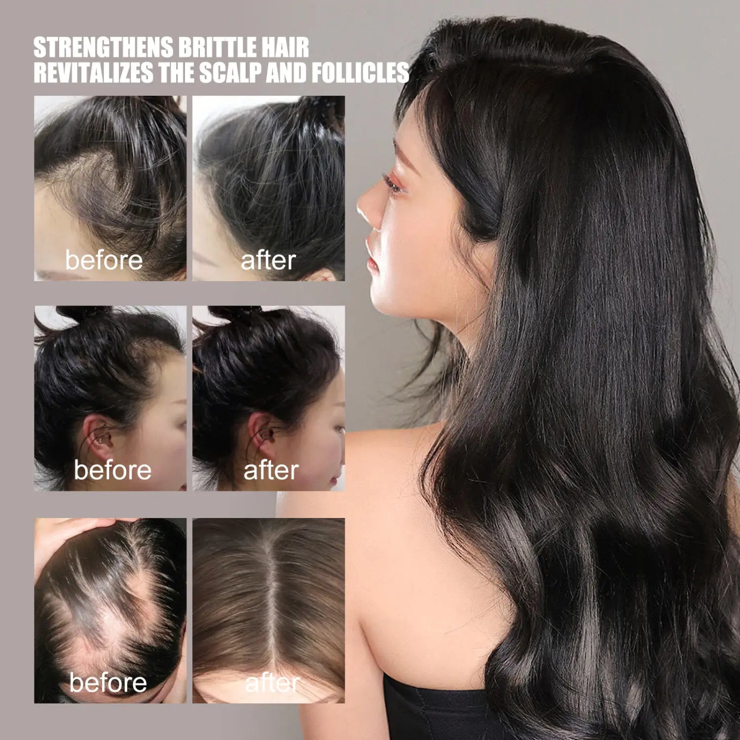 Une femme aux longs cheveux noirs, brillants et lustrés démontre une transformation spectaculaire, passant de mèches clairsemées et cassantes à des mèches épaisses et saines, grâce à un sérum de croissance des cheveux antichute, huile anti-chute, 30 ml.