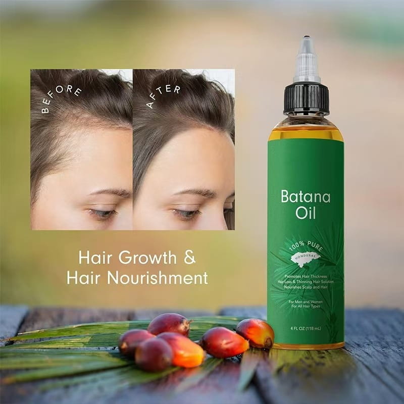 Botella verde de aceite de batana para el crecimiento del cabello y aceite esencial nutritivo con tapa cuentagotas negra que contiene un líquido de color ámbar.
