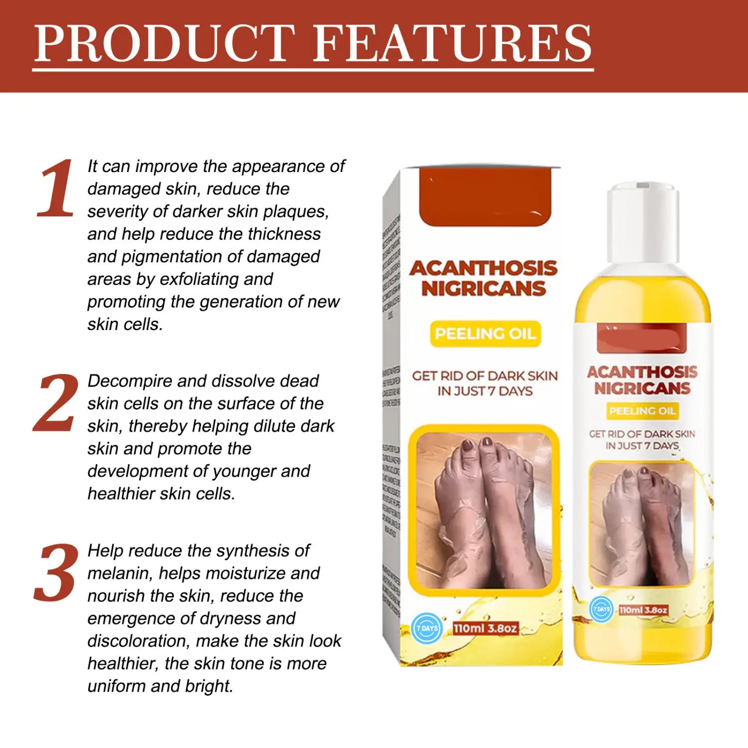A clear bottle of yellow acanthosis nigricans peeling oil with a white cap and matching box for skin lightening and dark spot treatment 110ml.