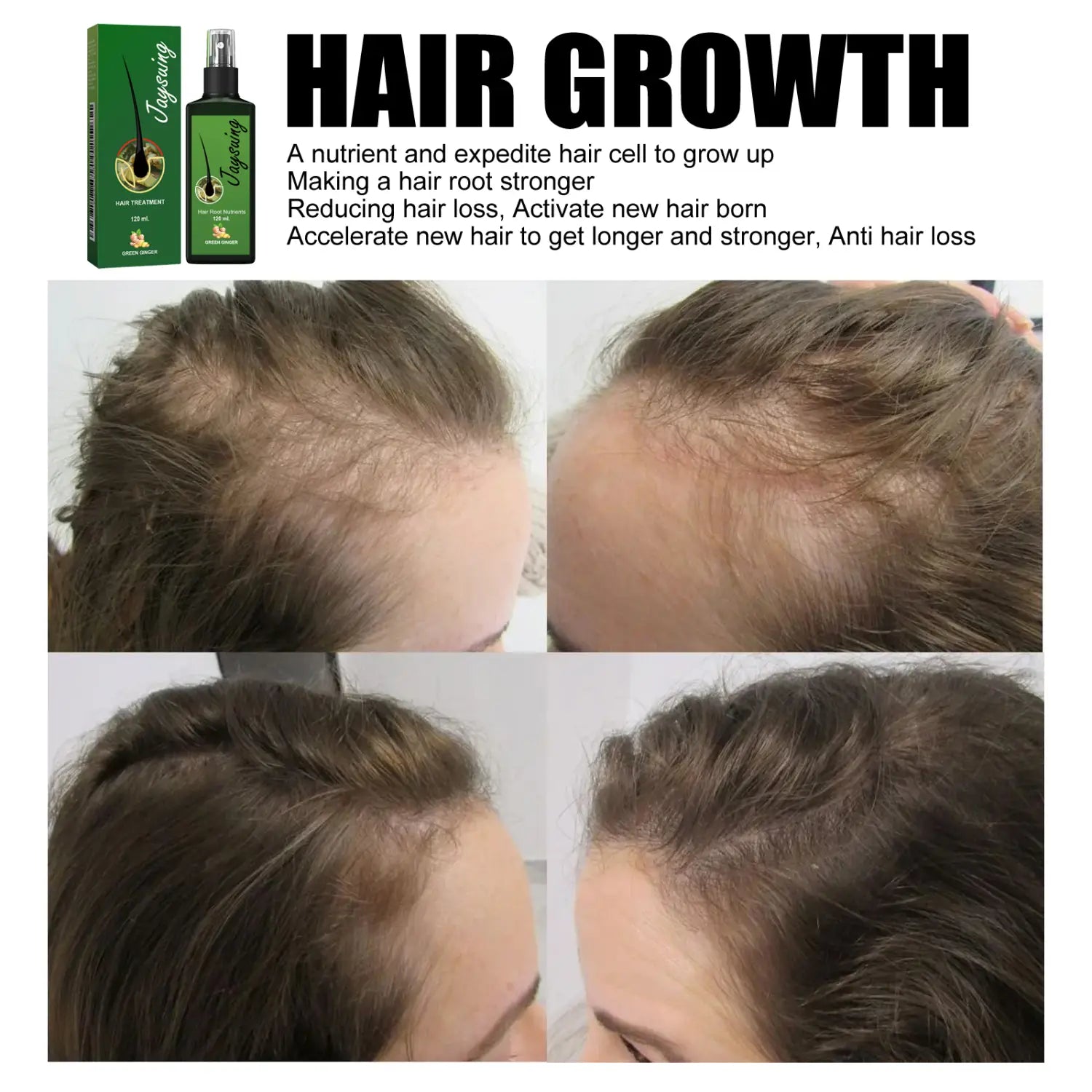 Frasco pulverizador verde rotulado como jagging, con tapa negra y logotipo circular dorado, que contiene un tratamiento de crecimiento capilar de 10 ml para nutrir el cuero cabelludo en el spray de crecimiento con jengibre para el cuidado del cabello, producto de 120 ml.