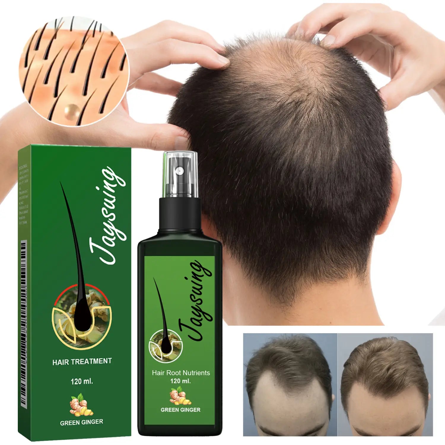 Spray de crecimiento para el cabello con jengibre verde para el cuidado del cabello, con tratamiento nutritivo para el cuero cabelludo, en un frasco negro elegante con boquilla rociadora transparente y embalaje botánico verde a juego de 120 ml.
