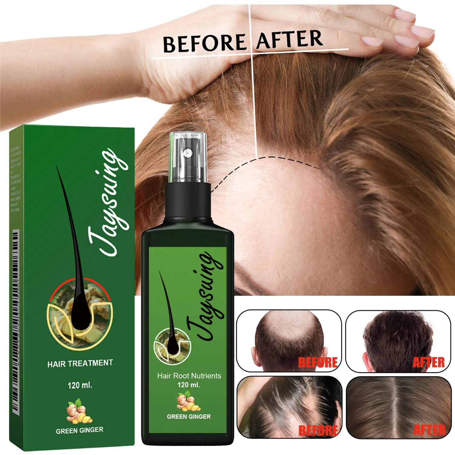 Spray de crecimiento para el cabello con jengibre verde para el cuidado del cabello, con tratamiento nutritivo para el cuero cabelludo, en un frasco negro elegante con boquilla rociadora transparente, envasado con una caja verde a juego de 120 ml