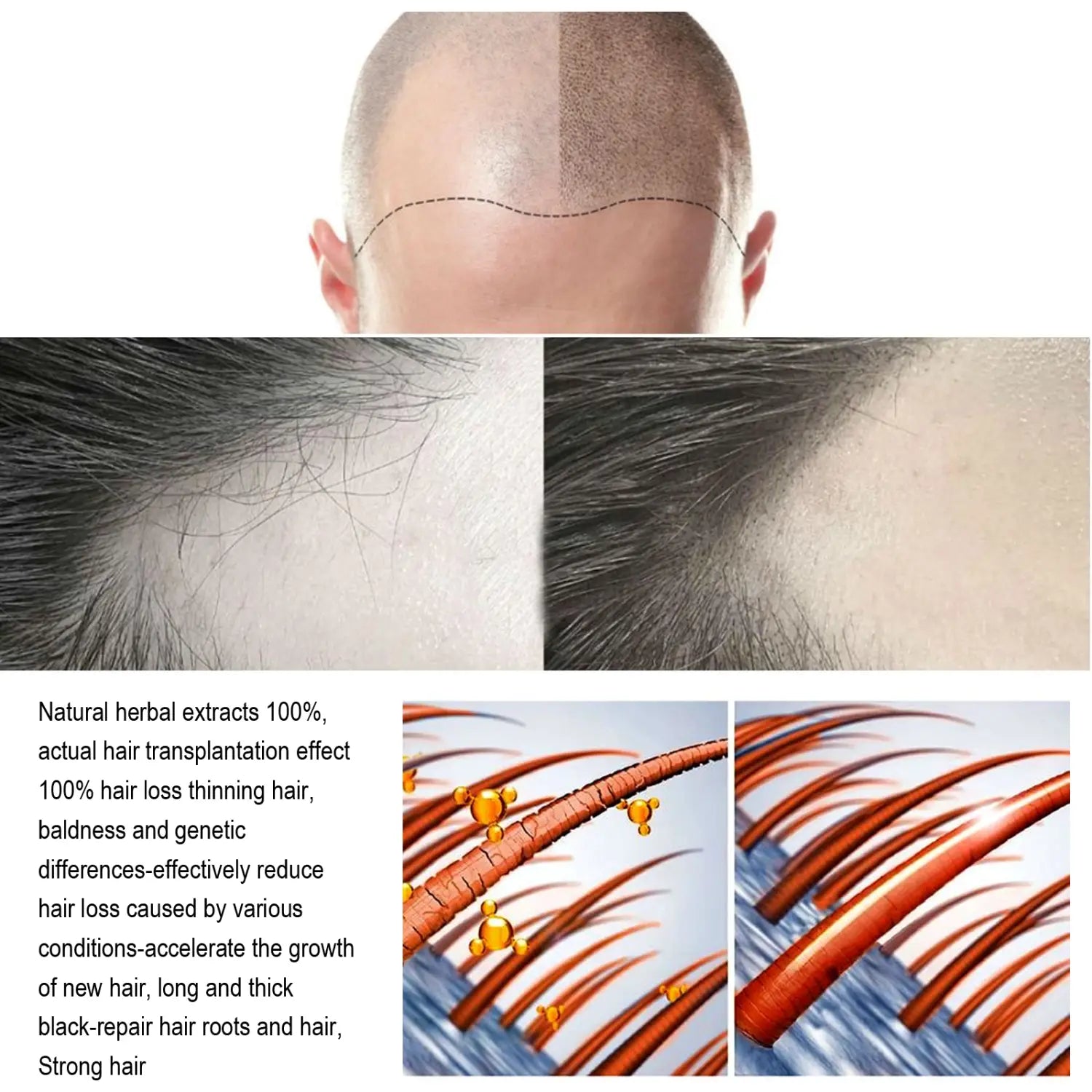 La imagen muestra una comparación antes y después de la textura del cuero cabelludo y los folículos pilosos mediante el spray de crecimiento con jengibre para el cuidado del cabello, tratamiento nutritivo del cuero cabelludo de 120 ml, con extractos herbales para mejorar la caída del cabello.