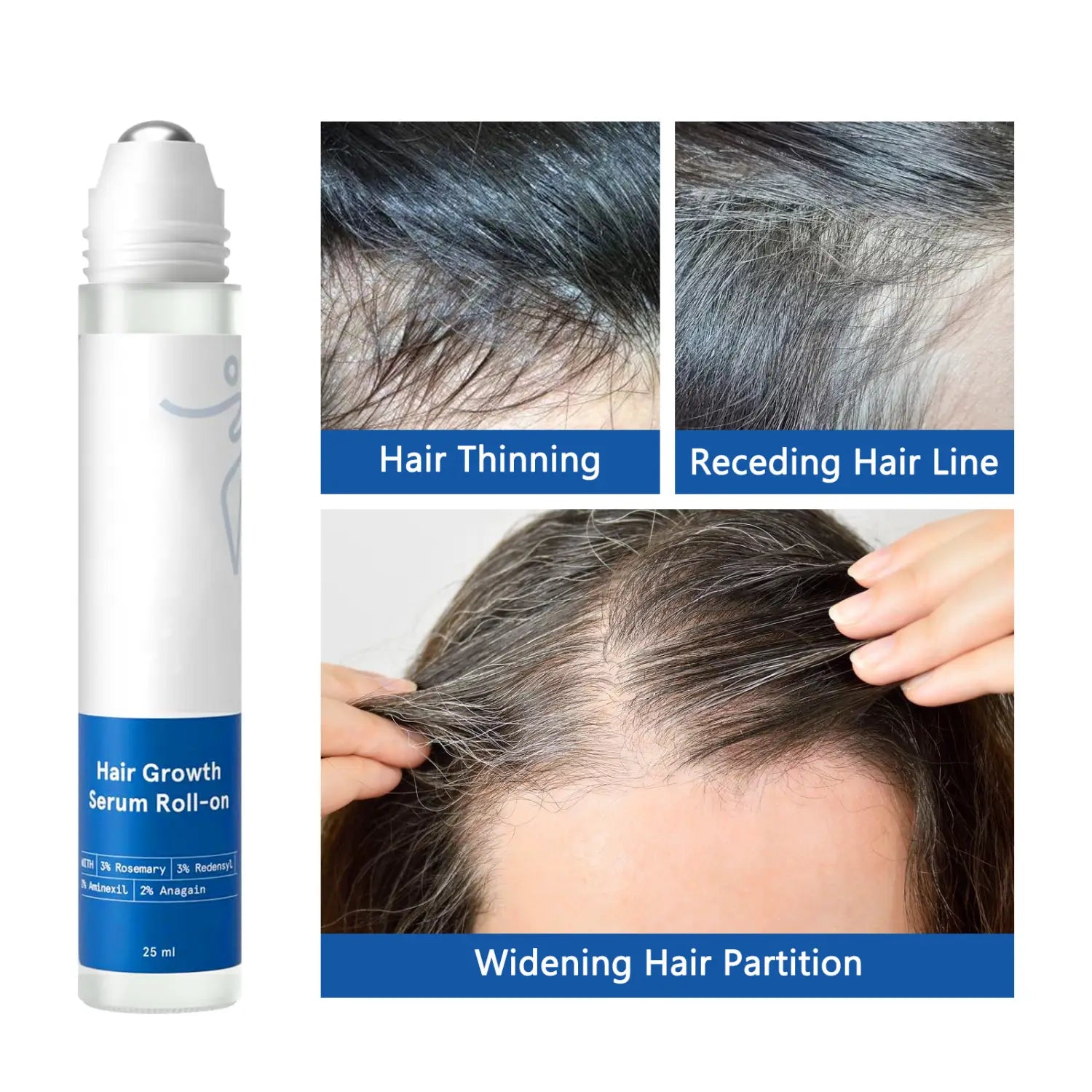 Sérum de croissance des cheveux en flacon-bille pour le cuir chevelu et les cheveux indisciplinés, avec un conditionnement blanc et bleu et un embout supérieur à bille argentée.