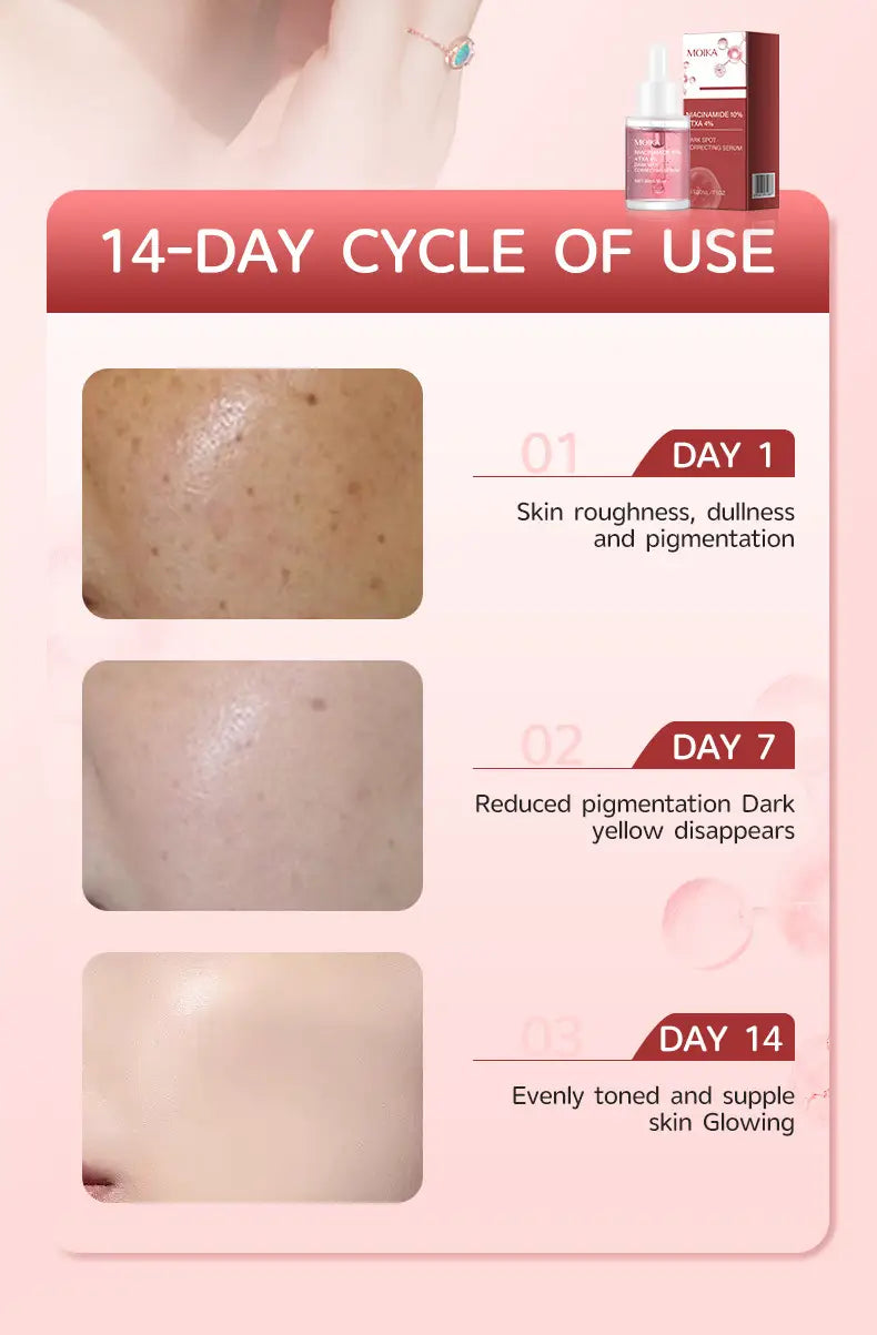 pink bottle of niacinamide 10% txa 4% dark spot correcting serum in red and white box labeled 14-day cycle of use with before and after skin results