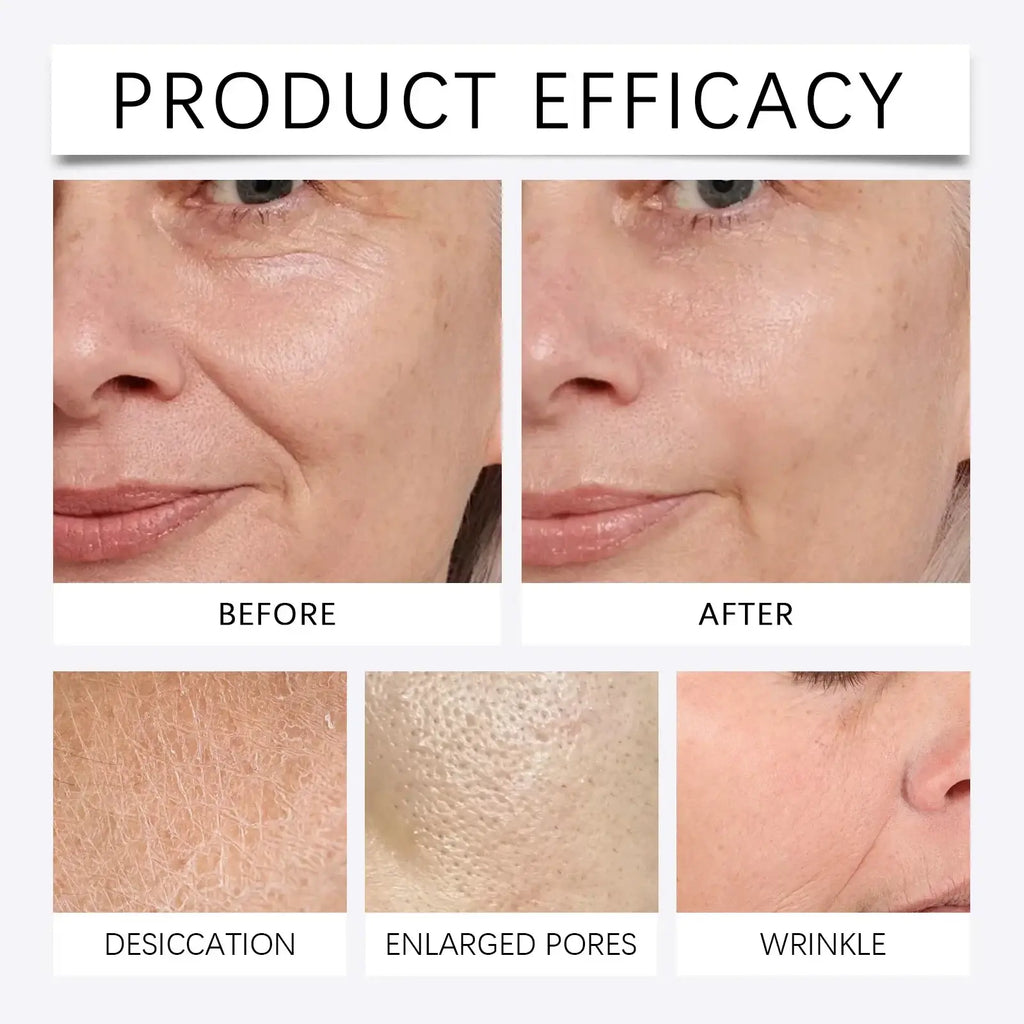 Before and after comparison showing skin hydration, pore reduction, and wrinkle smoothing using anti-aging microneedle serum kit