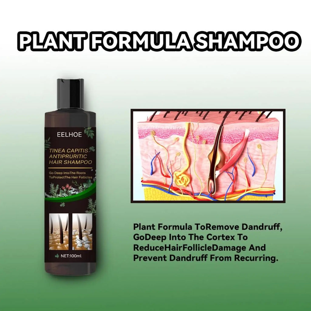 Dark brown bottle of eelhoe plant formula antipruritic hair shampoo with black cap and botanical label for itch relief and oil control