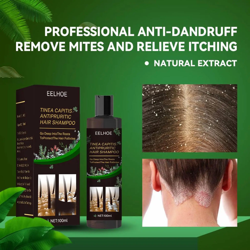 Black bottle of eelhoe tinea capitis antipruritic anti-dandruff shampoo with green botanical design and black cap for itch relief and oil control