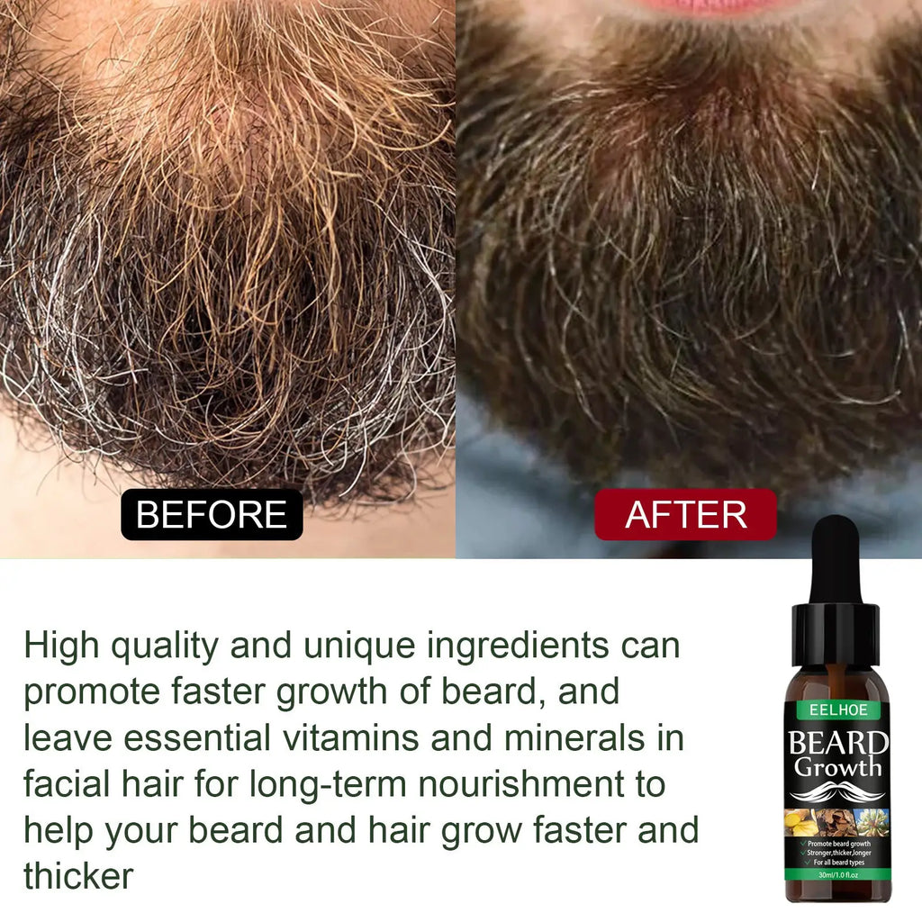 A dark brown glass bottle with black dropper cap labeled eelhoe beard growth oil serum for beard care 40ml