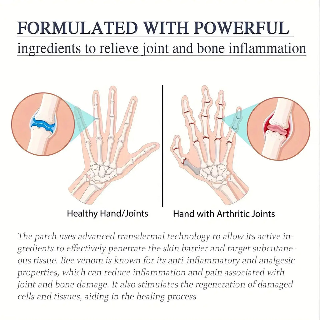The bee venom joint relief cream 60g medical adhesive patch designed to relieve joint and bone inflammation