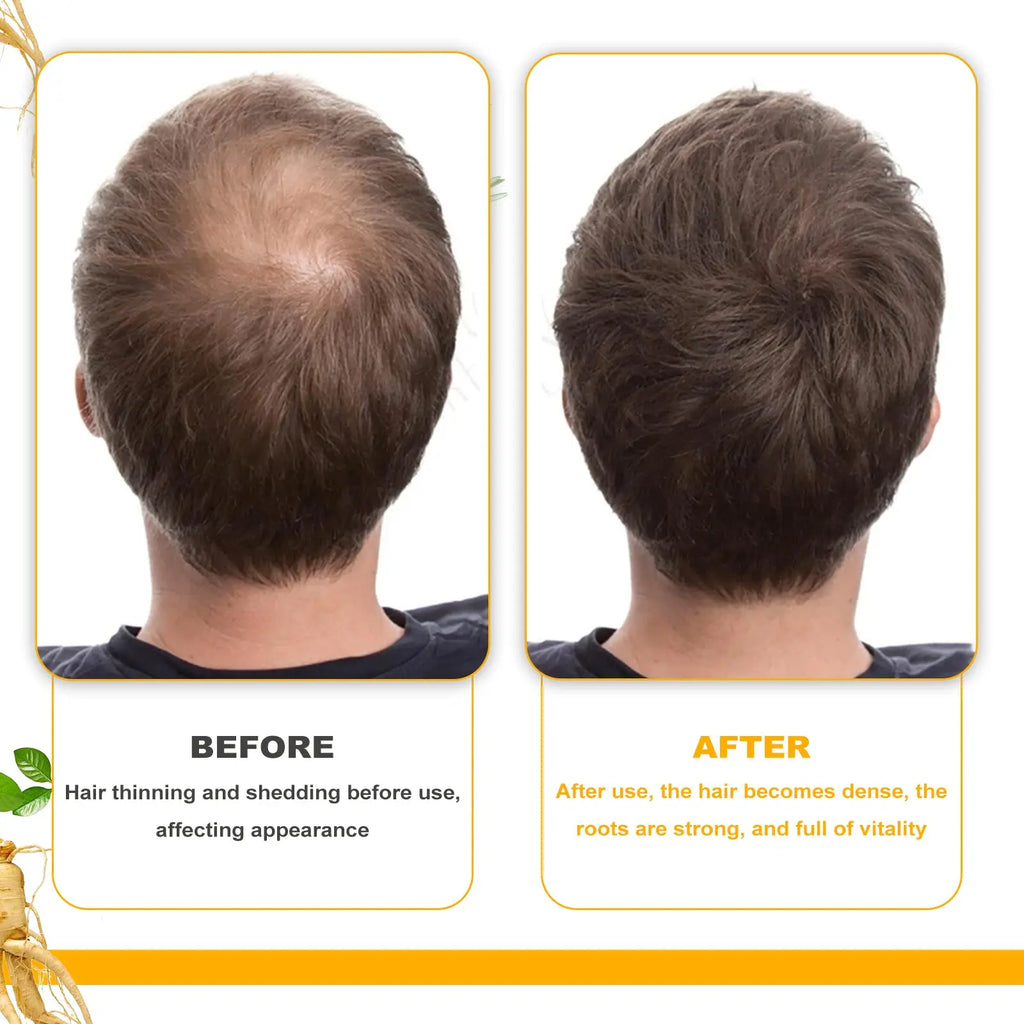 Before and after comparison showing biotin hair growth oil promoting thick and smooth hair from thinning and shedding