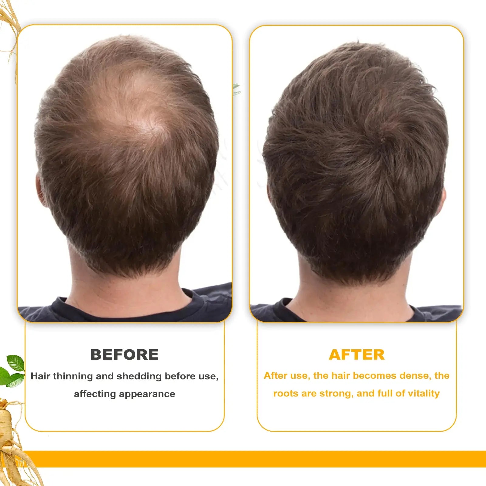 Before and after comparison showing biotin hair growth oil promoting thick and smooth hair from thinning and shedding
