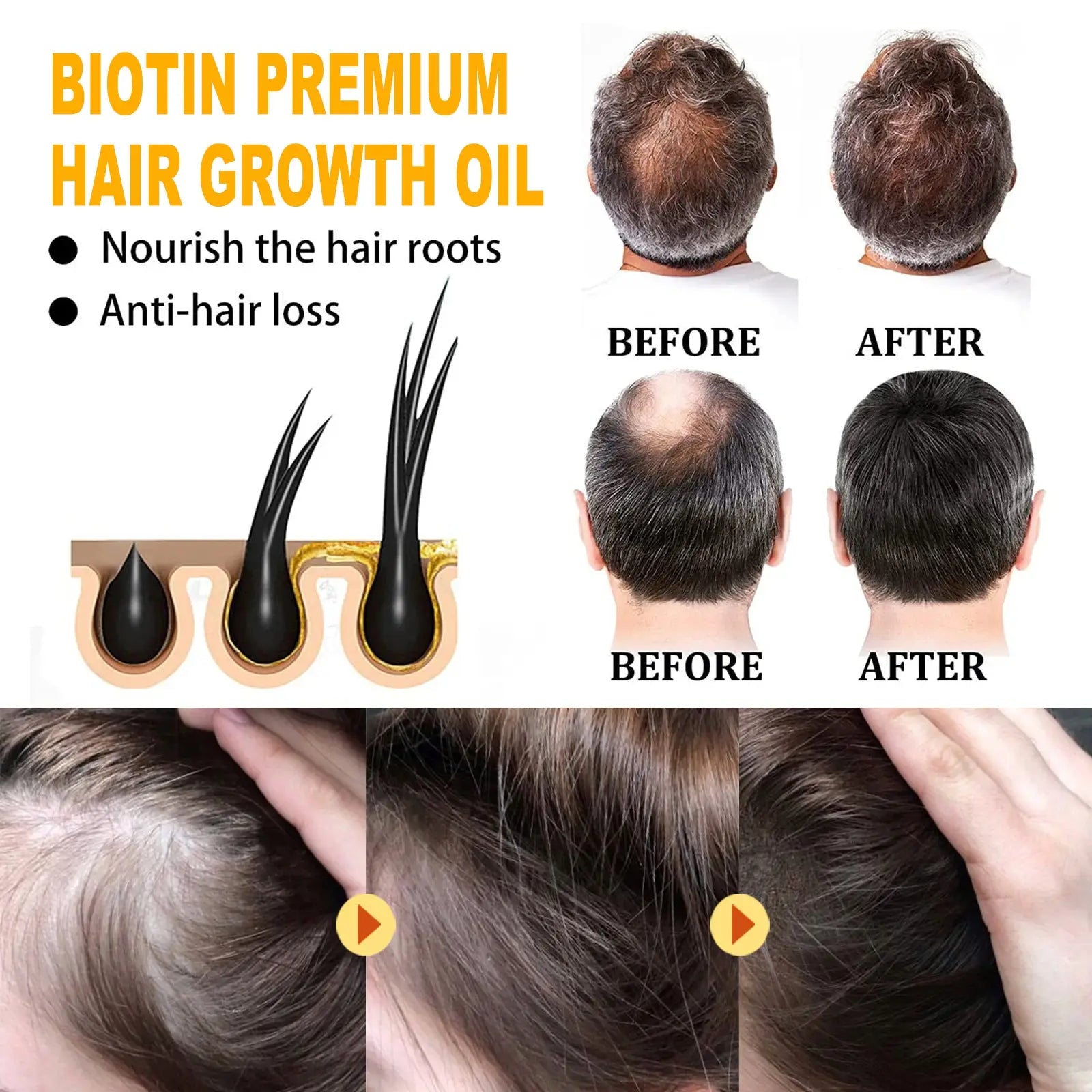 Biotin hair growth oil in a clear bottle with black cap for nourishing hair roots and preventing hair loss