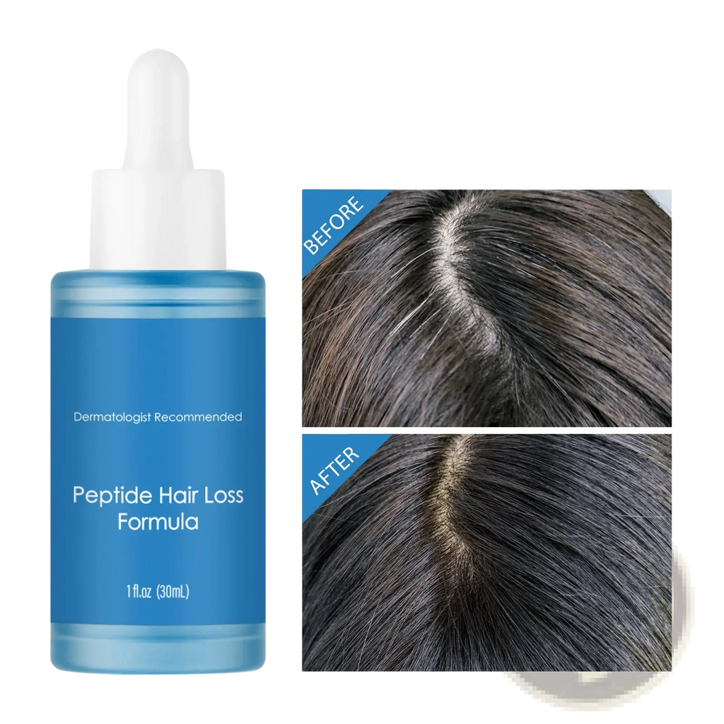 Blue glass bottle with white dropper cap containing dermatologist recommended peptide hair loss formula 30ml