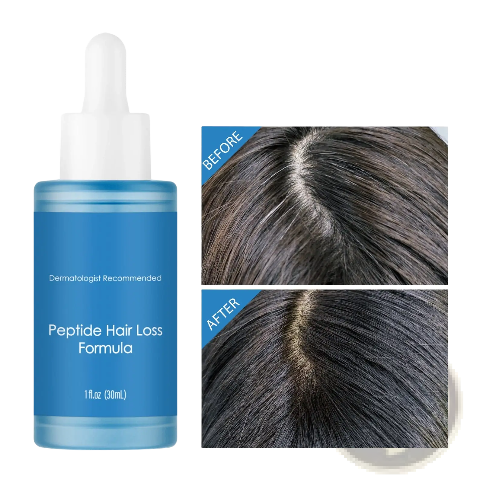 Blue glass bottle with white dropper cap containing dermatologist recommended peptide hair loss formula 30ml