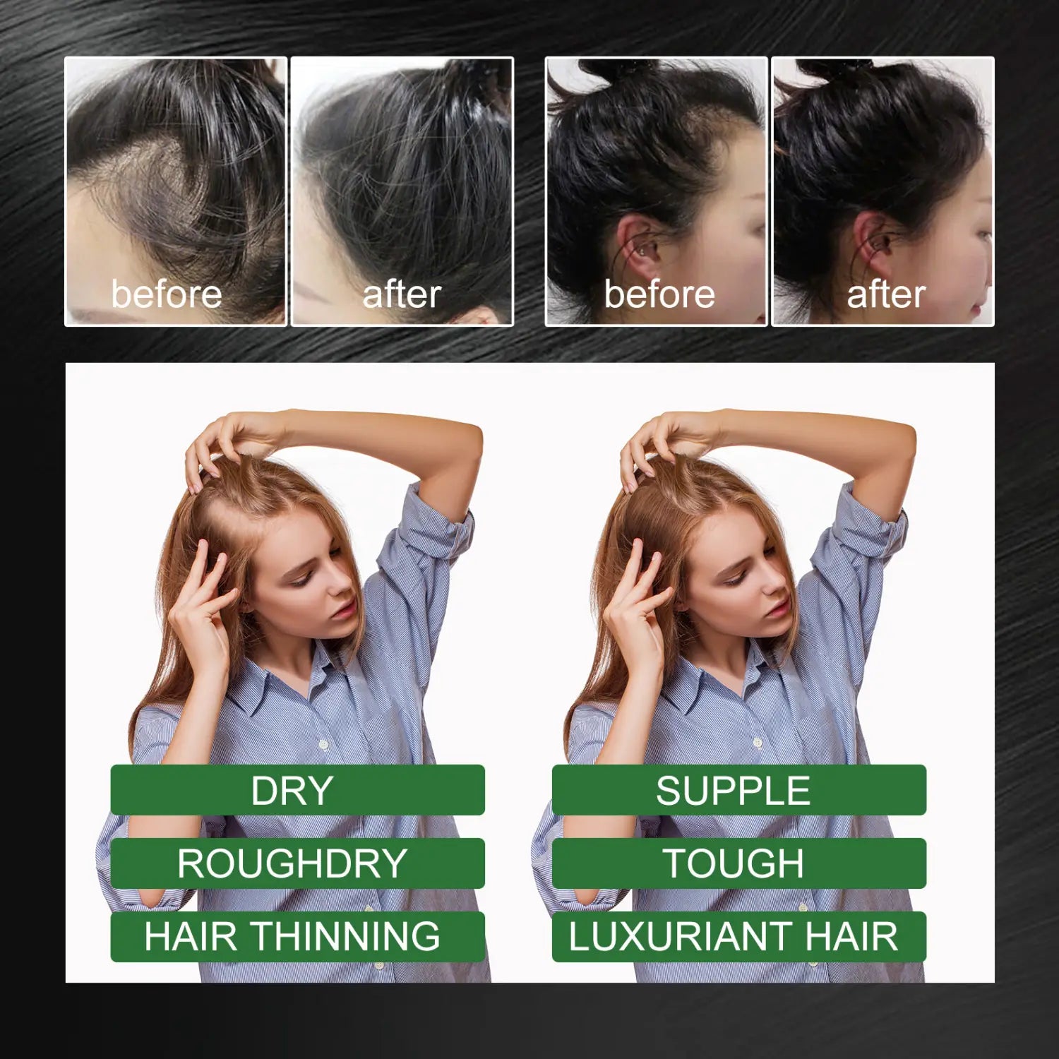 Vorher-Nachher-Vergleich bei Haarverdünnung, der die Verwandlung von trockenem, rauem Haar zu geschmeidigem, kräftigem, luxuriösem Haar mithilfe von Rosmarin-Essenzöl zur Förderung des Haarwachstums (60 ml) Ouhoe zeigt.