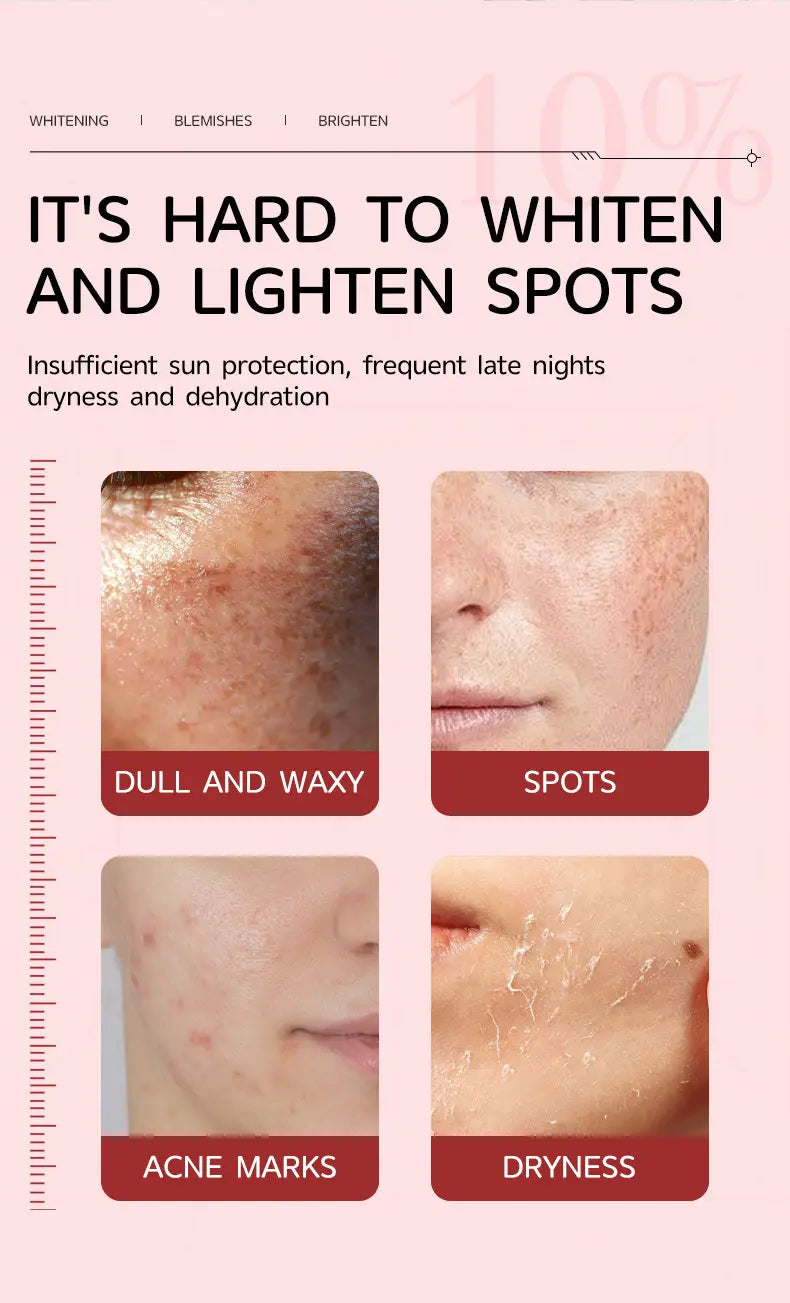 pink background with text and four images illustrating skin conditions such as dullness, spots, acne marks, and dryness for niacinamide 10% txa 4% dark spot correcting serum 30ml.
