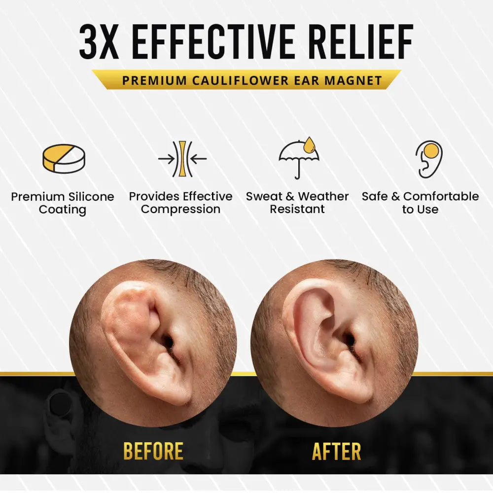 Premium silicone cauliflower ear compression magnet kit with silicone coating for effective compression and comfort