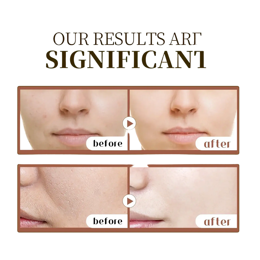 The image shows before and after results of centella asiatica ampoule improving texture and clarity on irritated skin