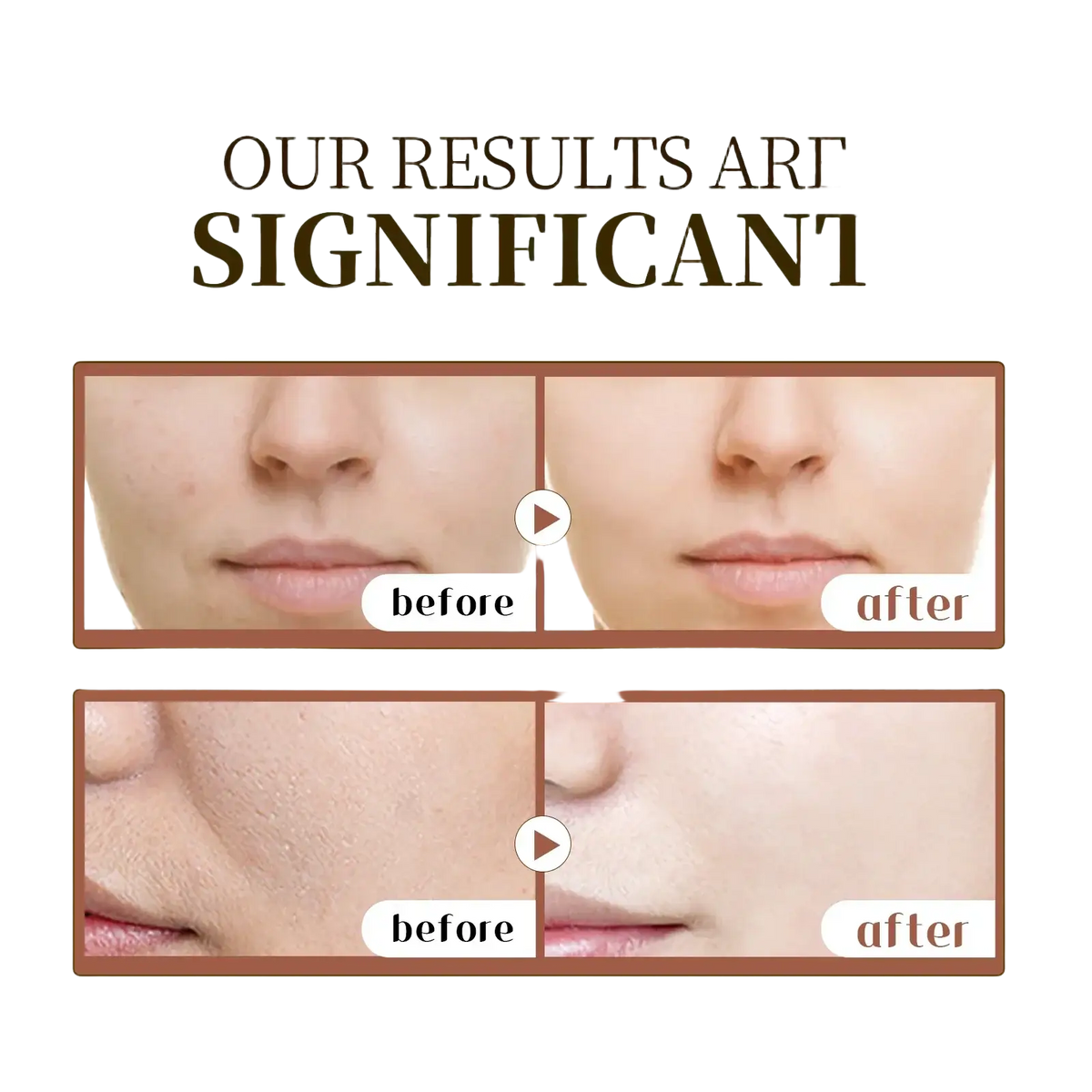 The image shows before and after results of centella asiatica ampoule improving texture and clarity on irritated skin