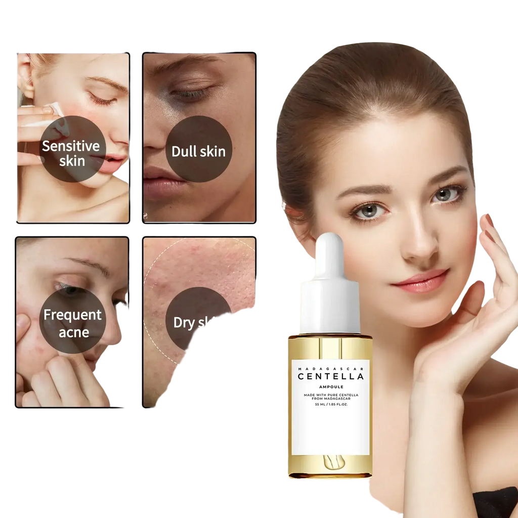 A sleek transparent glass bottle with white dropper cap and gold base contains centella asiatica ampoule for irritated skin cooling therapy