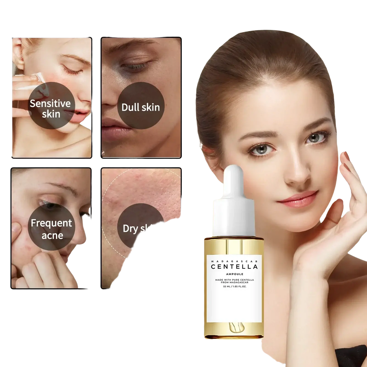 A sleek transparent glass bottle with white dropper cap and gold base contains centella asiatica ampoule for irritated skin cooling therapy