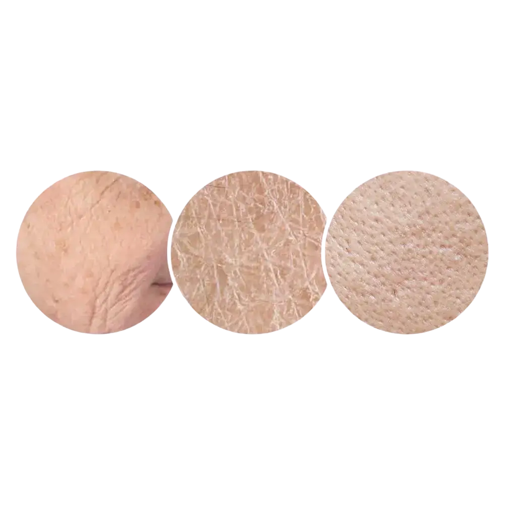 Close-ups of wrinkles rough skin and large pores treated with cherry blossom essence in travel size skincare set