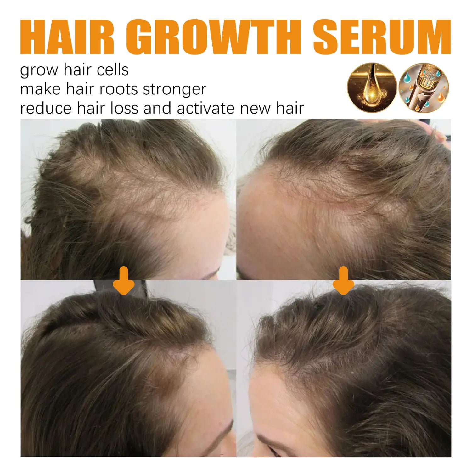 Huile sérum de croissance des cheveux antichute 30 ml, présentée dans un flacon au design de goutte dorée, pour renforcer les cheveux et favoriser leur croissance.