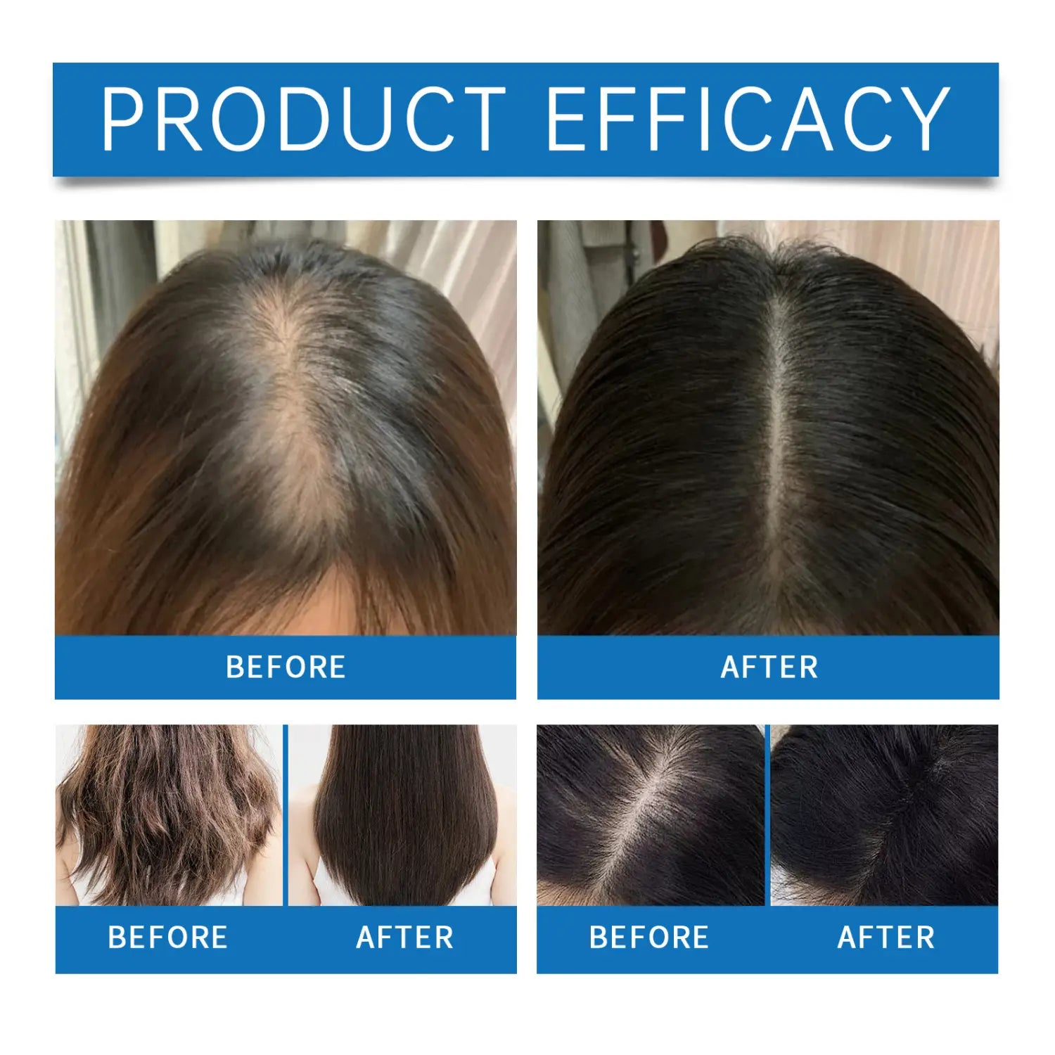 The image shows a before-and-after comparison of hair loss treatment results with denser and fuller dark brown hair after using scalp cooling hair ampoule vitamin B5 repairing essence.