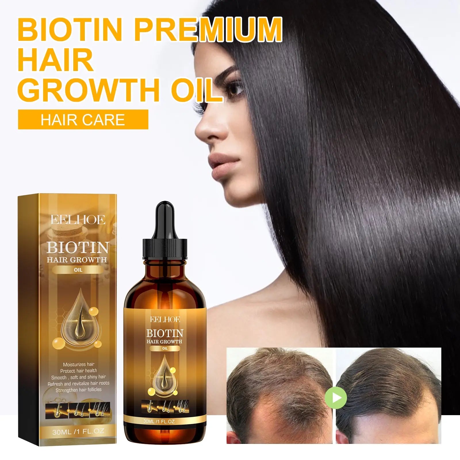 Amber glass bottle with black dropper cap and gold label of eelhoe biotin hair growth oil with rosemary and castor oil