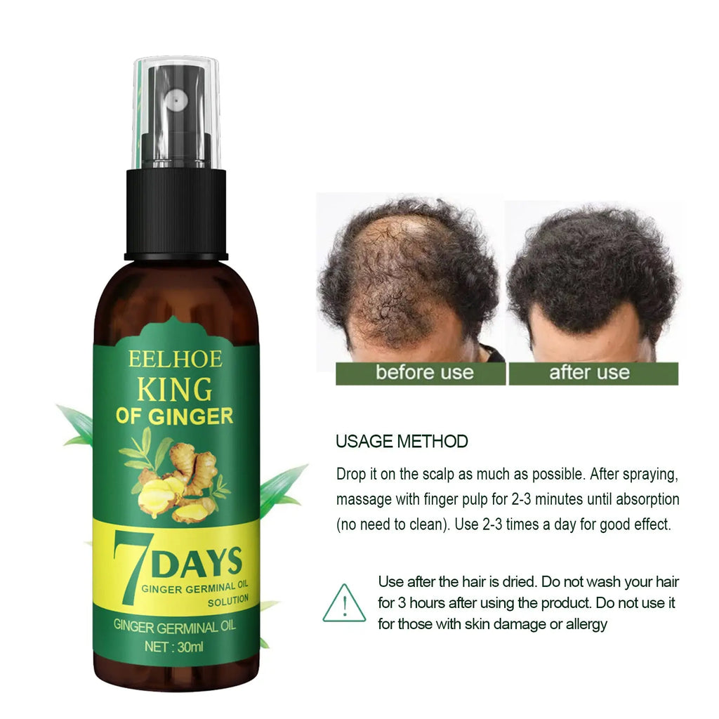 A dark amber glass spray bottle of Eelhoe King of Ginger 30ml hair growth strengthening oil with black pump and green label