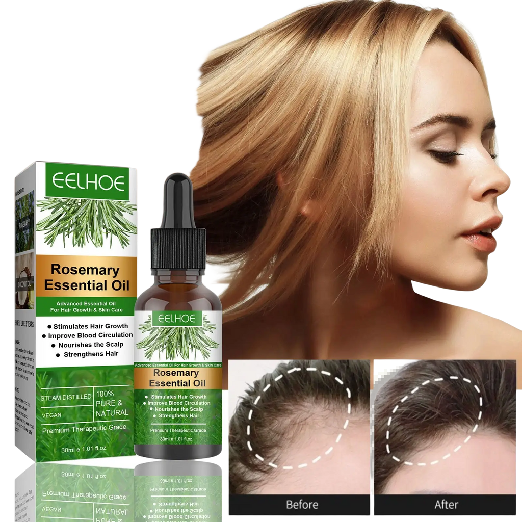 A sleek amber glass bottle of eelhoe rosemary hair growth oil with black dropper cap and green botanical label