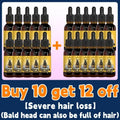 Dark amber glass bottles with black dropper caps and yellow labels featuring a stylized hair icon labeled fast hair essence for hair growth essential oil 30ml