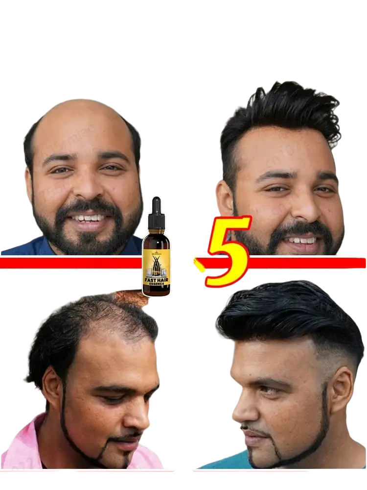 A dark amber glass bottle with black dropper cap and gold label fast hair fast hair growth essential oil 30ml