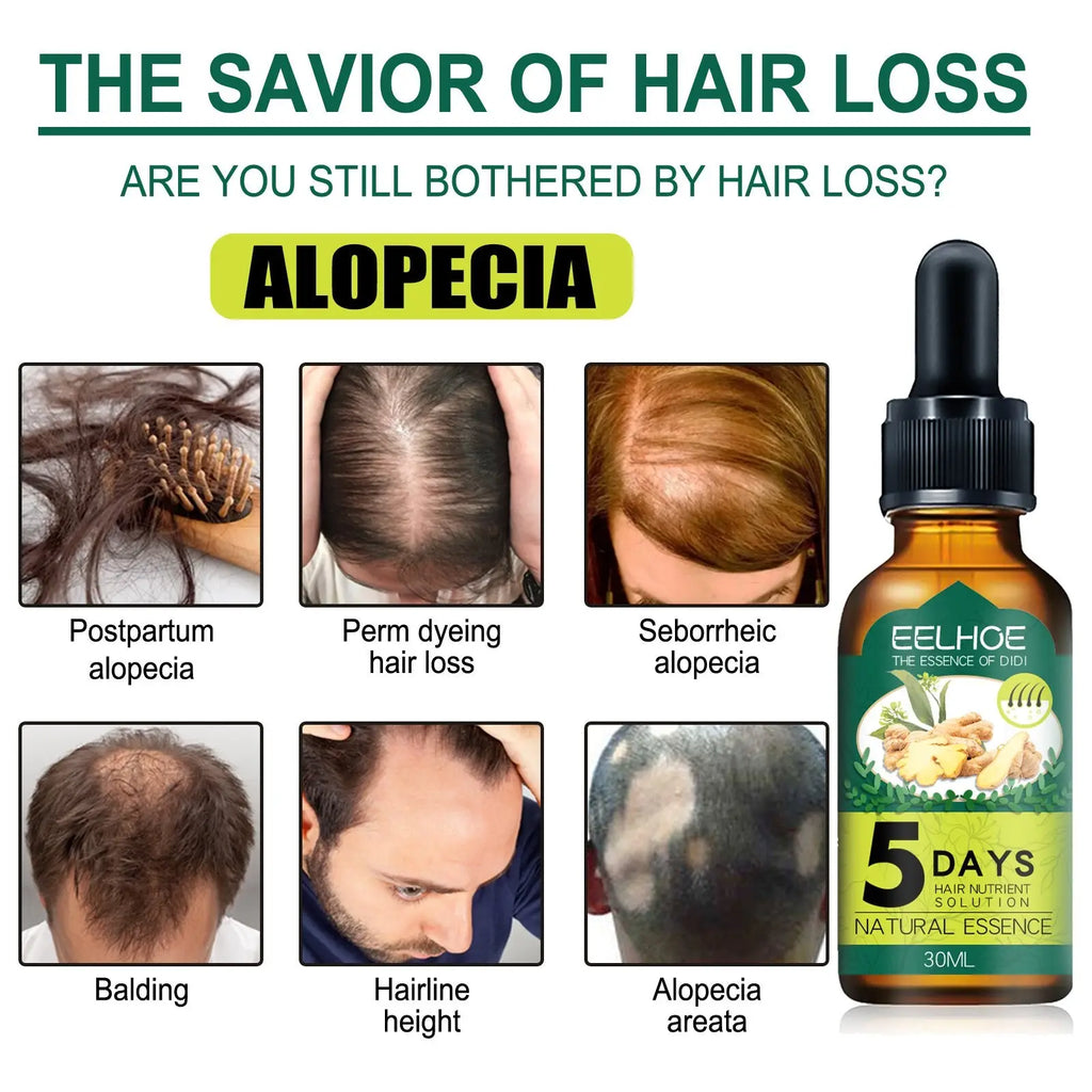 Amber glass bottle with black dropper and green ginger label for eelhoe 5 days hair nutrient solution essential oil