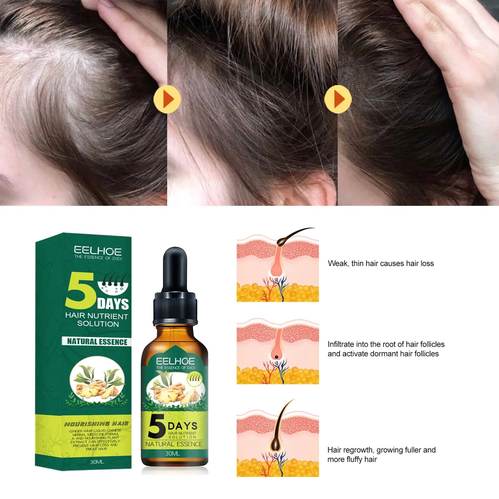 Eelhoe ginger hair essential oil 5 days nutrient solution in amber glass dropper bottle with green label and box